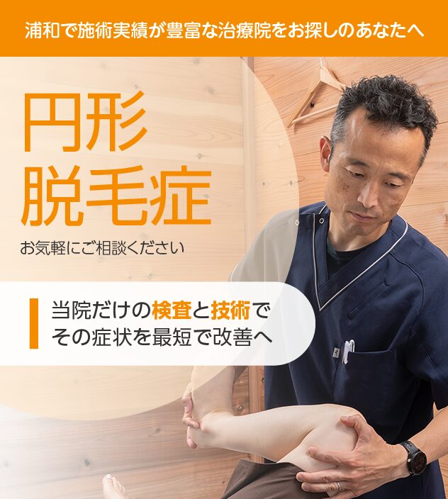 円形脱毛症