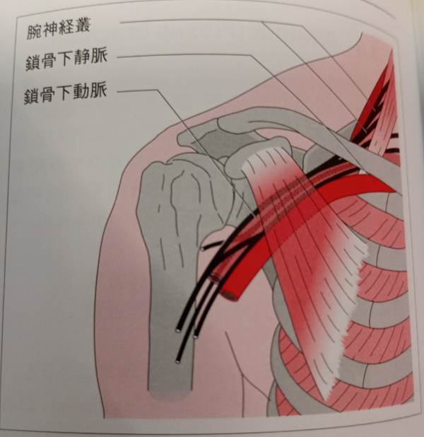 小胸筋症候群とは?