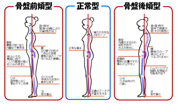 腰の椎間板ヘルニアの痛みを根本改善する方法 | 武蔵浦和ブロッサム