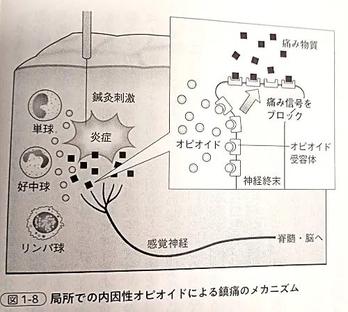 鍼灸は何故効くの？ | 武蔵浦和ブロッサム鍼灸治療院・整体院
